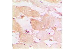 Immunohistochemical analysis of CD183 staining in human muscle formalin fixed paraffin embedded tissue section. (CXCR3 antibody  (Center))