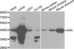 Western blot analysis of extracts of various cell lines, using ADA antibody. (ADA antibody)