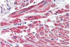 Human Heart (formalin-fixed, paraffin-embedded) stained with SNAI2 antibody ABIN214479 at 2. (SLUG antibody  (Internal Region))