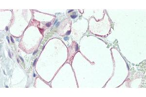 DCBLD2 antibody