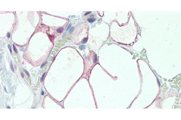 DCBLD2 antibody