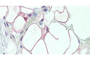 Immunohistochemistry of paraffin-embedded Adipose Tissue using DCBLD2 Polyclonal Antibody at dilution of 1:50. (DCBLD2 antibody)