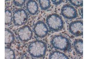 Detection of GLa in Human Rectum Tissue using Polyclonal Antibody to Galactosidase Alpha (GLa) (GLA antibody  (AA 1-80))