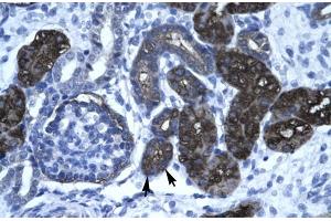 Human kidney; DKFZP761C169 antibody - N-terminal region in Human kidney cells using Immunohistochemistry (GC-Rich Promoter Binding Protein 1 (GPBP1) (N-Term) antibody)