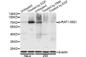 Western blot analysis of extracts of HeLa and 293T cells, using Phospho-RAF1-S621 antibody.