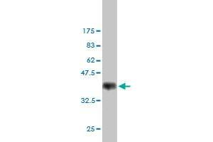 Western Blotting (WB) image for anti-FYN Oncogene Related To SRC, FGR, YES (FYN) (AA 1-90) antibody (ABIN560966)