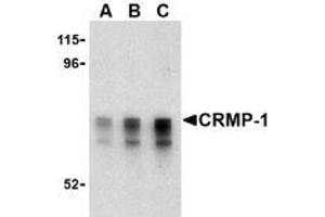 Western blot analysis of CRMP1 in Caco-2 cell lysate with AP30243PU-N CRMP1 antibody at (A) 1, (B) 2 and (C) 4 μg/ml.