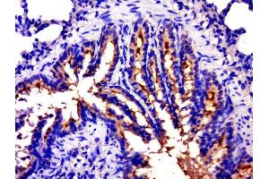 Paraformaldehyde-fixed, paraffin embedded rat lung tissue, Antigen retrieval by boiling in sodium citrate buffer(pH6) for 15min, Block endogenous peroxidase by 3% hydrogen peroxide for 30 minutes, Blocking buffer (normal goat serum) at 37°C for 20min, Antibody incubation with Rabbit Anti-EGFR5 Polyclonal Antibody, Unconjugated  at 1:500 overnight at 4°C, followed by a conjugated secondary and DAB staining (CLEC14A antibody  (AA 260-310))