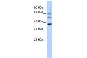 Image no. 1 for anti-UDP Glucuronosyltransferase 1 Family, Polypeptide A9 (UGT1A9) (AA 108-157) antibody (ABIN6743112) (UGT1A9 antibody  (AA 108-157))