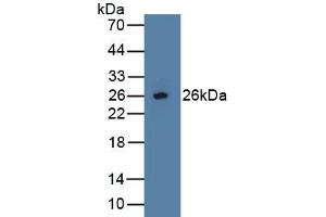 Detection of Recombinant OPG, Human using Polyclonal Antibody to Osteoprotegerin (OPG) (Osteoprotegerin antibody  (AA 1-196))