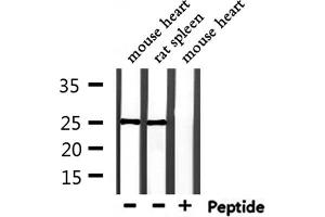 Western blot analysis of extracts from mouse heart and rat spleen, using RAB28 Antibody. (RAB28 antibody  (Internal Region))