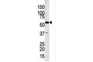 Glycerol kinase antibody used in western blot to detect GKP2 in Jurkat lysate (GK2 antibody  (AA 487-515))