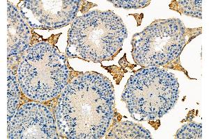 ABIN6264044 and ABIN6273287 at 1/100 staining Mouse testis tissue by IHC-P. (Parvin, beta antibody  (C-Term))