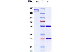 Anti- Human/Mouse/Monkey CTGF( Pamrevlumab) In Vivo Mab on SDS-PAGE under reducing (R) condition. (Recombinant CCN2 (Pamrevlumab Biosimilar) antibody)