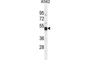 Western Blotting (WB) image for anti-NME Gene Family Member 9 (NME9) antibody (ABIN2995969)