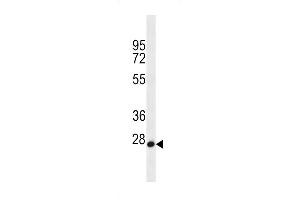 MED22 Antibody (N-term) (ABIN656595 and ABIN2845856) western blot analysis in HL-60 cell line lysates (35 μg/lane). (MED22 antibody  (N-Term))