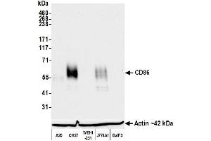 Western Blotting (WB) image for anti-CD86 (CD86) (AA 24-245) antibody (ABIN7795646)