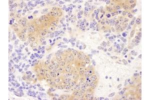 anti-Chaperonin Containing TCP1, Subunit 8 (Theta) (CCT8) (AA 1-50) antibody