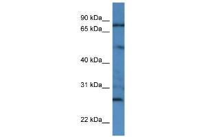 WB Suggested Anti-GOLGA1 Antibody Titration: 0. (GOLGA1 antibody  (N-Term))