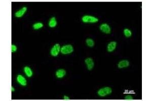Immunostaining analysis in HeLa cells. (MATR3 antibody)