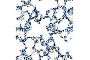 Immunohistochemistry of paraffin embedded mouse lung using P4H (ABIN7074215) at dilution of 1:700 (400x lens) (HIF Prolyl Hydroxylase antibody)