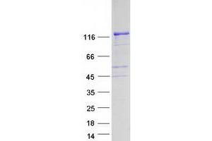 Western Blotting (WB) image for FYVE, RhoGEF and PH Domain Containing 1 (FGD1) protein (Myc-DYKDDDDK Tag) (ABIN2721027)
