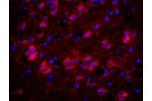 Formalin-fixed and paraffin-embedded rat brain labeled with Anti-CHRM4/mAChR M4 Polyclonal Antibody, Unconjugated (ABIN1387838) 1:200, overnight at 4°C, The secondary antibody was Goat Anti-Rabbit IgG, PE conjugated used at 1:200 dilution for 40 minutes at 37°C. (CHRM4 antibody  (AA 1-31))