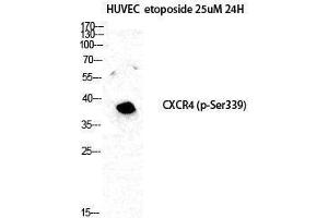 Western Blotting (WB) image for anti-Chemokine (C-X-C Motif) Receptor 4 (CXCR4) (pSer339) antibody (ABIN3179770) (CXCR4 antibody  (pSer339))
