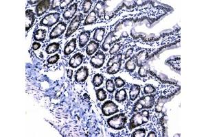 IHC testing of FFPE rat small intestine tissue with CBX3 antibody at 1ug/ml. (CBX3 antibody)
