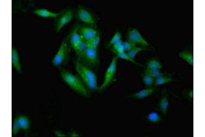 Immunofluorescent analysis of Hela cells using ABIN7171000 at dilution of 1:100 and Alexa Fluor 488-congugated AffiniPure Goat Anti-Rabbit IgG(H+L) (SOCS3 antibody  (AA 1-224))