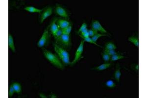 Immunofluorescent analysis of Hela cells using ABIN7171000 at dilution of 1:100 and Alexa Fluor 488-congugated AffiniPure Goat Anti-Rabbit IgG(H+L)