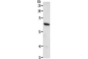 Western Blotting (WB) image for anti-Frizzled Family Receptor 4 (FZD4) antibody (ABIN2428931)