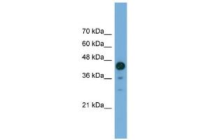 WB Suggested Anti-C2orf62 Antibody Titration: 0. (C2orf62 antibody  (C-Term))