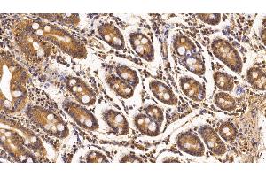 Detection of Surv in Porcine Small intestine Tissue using Monoclonal Antibody to Survivin (Surv) (Survivin antibody  (AA 1-142))