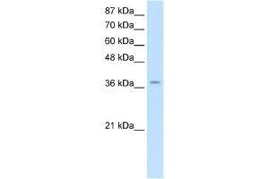 WB Suggested Anti-ZNF550 Antibody Titration:  2. (ZNF550 antibody  (Middle Region))