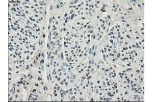 Immunohistochemical staining of paraffin-embedded Ovary tissue using anti-HDAC10mouse monoclonal antibody.