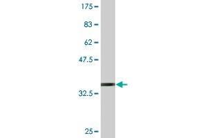 Western Blot detection against Immunogen (34. (SLC1A2 antibody  (AA 160-239))