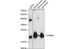 Western blot analysis of extracts of various cell lines, using V antibody (ABIN3021846, ABIN3021847, ABIN1513674 and ABIN6216136) at 1:3000 dilution. (VAMP2 antibody  (AA 1-100))