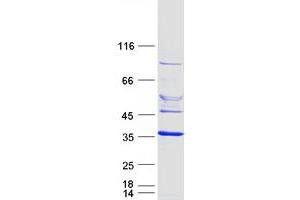 Validation with Western Blot (ELMOD2 Protein (Myc-DYKDDDDK Tag))