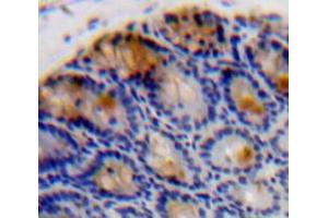 Used in DAB staining on fromalin fixed paraffin-embedded Intestine tissue (IL-37 antibody  (AA 46-218))