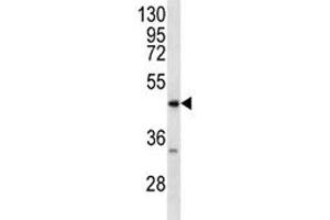 RAGE antibody western blot analysis in MDA-MB231 lysate. (RAGE antibody  (AA 348-378))