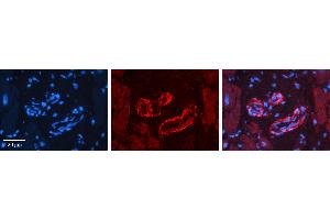 Rabbit Anti-SPRY2 Antibody   Formalin Fixed Paraffin Embedded Tissue: Human heart Tissue Observed Staining: Cytoplasmic in vasculature Primary Antibody Concentration: 1:100 Other Working Concentrations: 1:600 Secondary Antibody: Donkey anti-Rabbit-Cy3 Secondary Antibody Concentration: 1:200 Magnification: 20X Exposure Time: 0. (SPRY2 antibody  (N-Term))