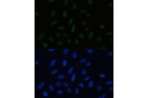 Immunofluorescence analysis of U-2 OS cells using PELP1 Polyclonal Antibody (ABIN3023501, ABIN3023502, ABIN3023503 and ABIN6220149) at dilution of 1:100 (40x lens). (PELP1 antibody  (AA 1021-1180))