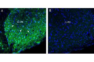 Free-floating frozen spinal cord sections from a paraformaldehyde-perfused rat were incubated with Anti-NaV1.