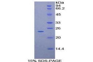 SDS-PAGE (SDS) image for Peptidylprolyl Isomerase D (PPID) (AA 7-191) protein (His tag) (ABIN2124540) (PPID Protein (AA 7-191) (His tag))