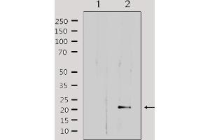 Western blot analysis of extracts from HepG2, using MRPL32 Antibody. (MRPL32 antibody  (Internal Region))