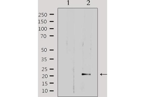 MRPL32 antibody  (Internal Region)