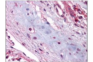 Human Lung, Chondrocytes: Formalin-Fixed, Paraffin-Embedded (FFPE) (UCMA antibody  (C-Term))