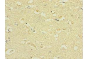 Immunohistochemistry of paraffin-embedded human brain tissue using ABIN7169924 at dilution of 1:100 (SCN3A antibody  (AA 274-400))