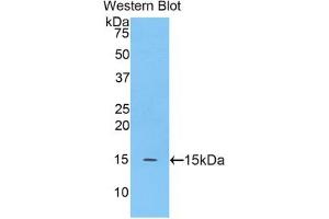 Western blot analysis of the recombinant protein. (MGEA5 antibody  (AA 695-814))